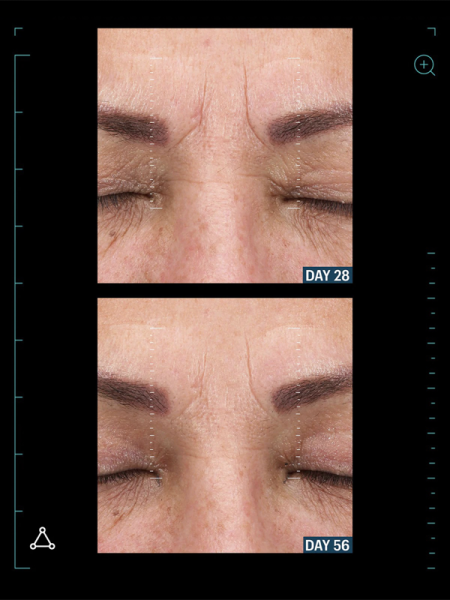 Allies of Skin Разглаживающая мультипептидная сыворотка с фактором роста Multi Peptides&GF Advanced Lifting Serum 30 мл фото 2