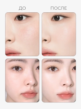 BI4750 #4