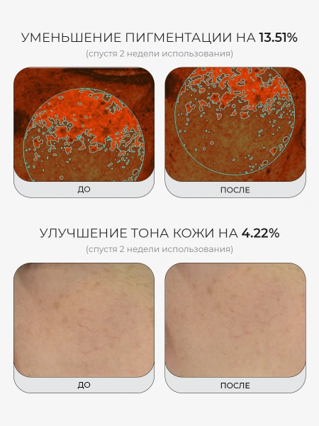 Medicube Успокаивающий тонер с ПДРН и комплексом пептидов PDRN Pink CICA Soothing Toner 250 мл фото 4