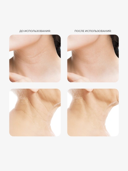 Arocell Регенерирующий антивозрастной крем для шеи и декольте с PDRN Super Neck Cream 80 гр фото 4