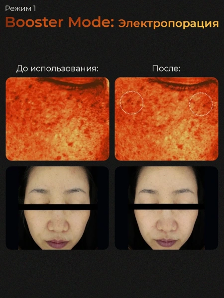 Medicube Микротоковый аппарат для лица  6-в-1 AGE-R Booster Pro Pink  фото 6