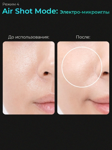 Medicube Микротоковый аппарат для лица  6-в-1 AGE-R Booster Pro Pink  фото 11