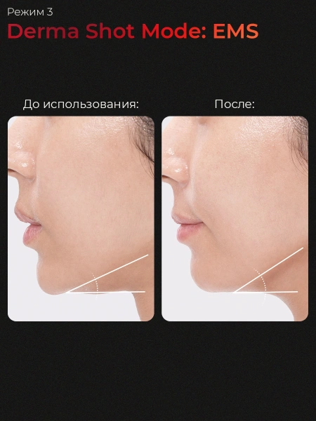 Medicube Микротоковый аппарат для лица  6-в-1 AGE-R Booster Pro Pink  фото 9
