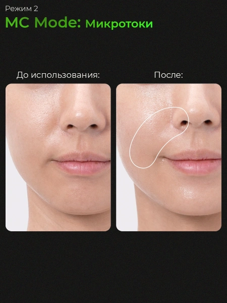 Medicube Микротоковый аппарат для лица  6-в-1 AGE-R Booster Pro Pink  фото 7