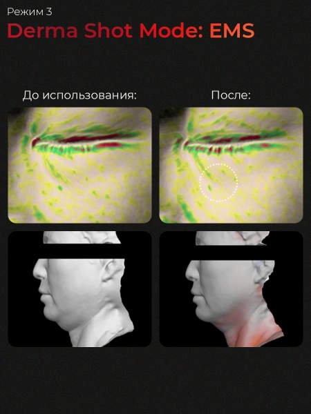 Medicube Микротоковый аппарат для лица  6-в-1 AGE-R Booster Pro Pink  фото 10