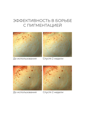 Антивозрастные сыворотки и кремы для лица