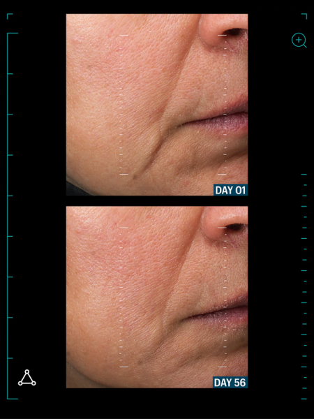 Allies of Skin Разглаживающая мультипептидная сыворотка с фактором роста Multi Peptides&GF Advanced Lifting Serum 30 мл фото 5
