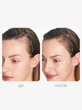 Сыворотка для кожи головы для роста волос