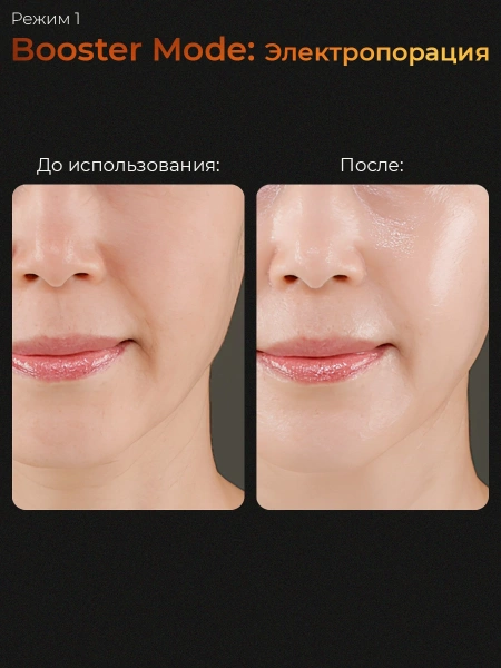 Medicube Микротоковый аппарат для лица  6-в-1 AGE-R Booster Pro Pink  фото 5